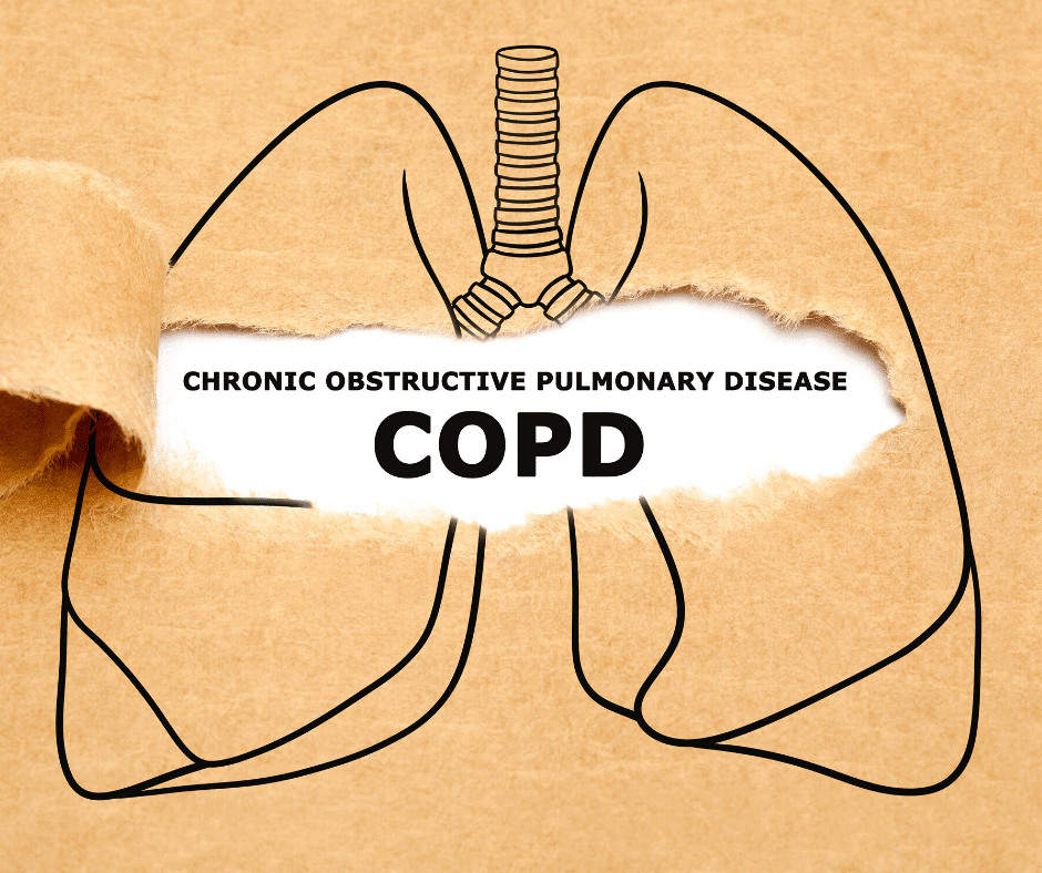 COPD: What You Need to Know
