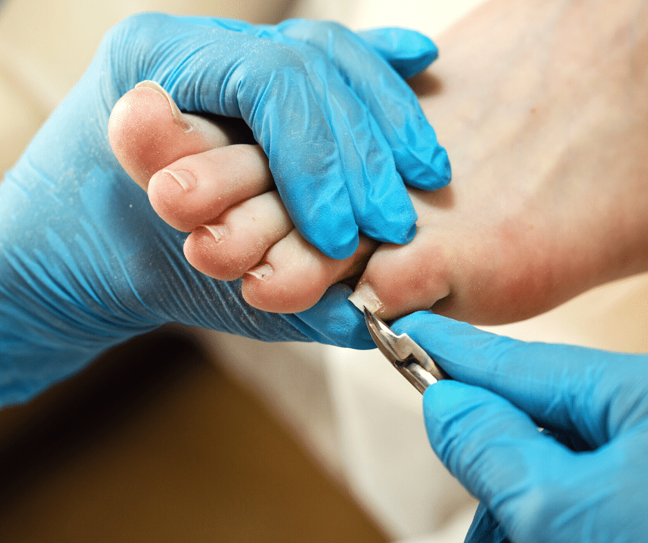 Q&A with a Foot Care Nurse