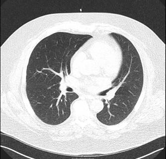 Imaging of the lower portion of lungs