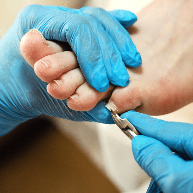 Q&A with a Foot Care Nurse